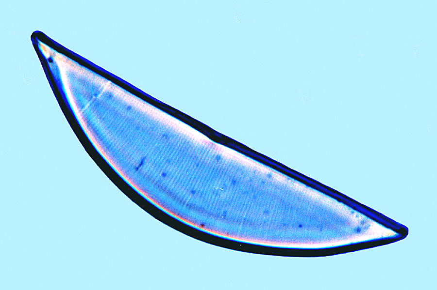 Amphora Amphora pseudohyalina